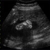 2D Ultrasound Image