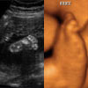 Platinum Two Ultrasound Images